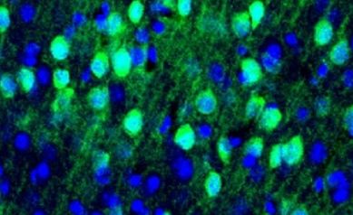 Manipulating Fluid Flows in the Brain Could Save Lives, Improve Recovery Post-TBI