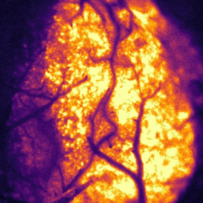 New Imaging Method Illuminates Oxygen's Journey in the Brain