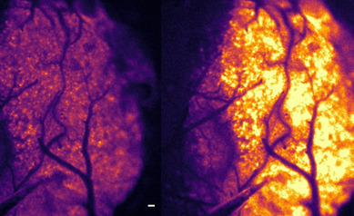 New Imaging Method Illuminates Oxygen's Journey in the Brain