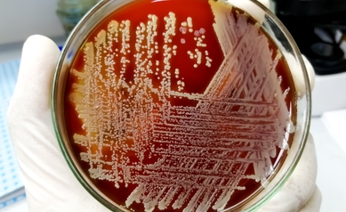 Staphylococcus aureus