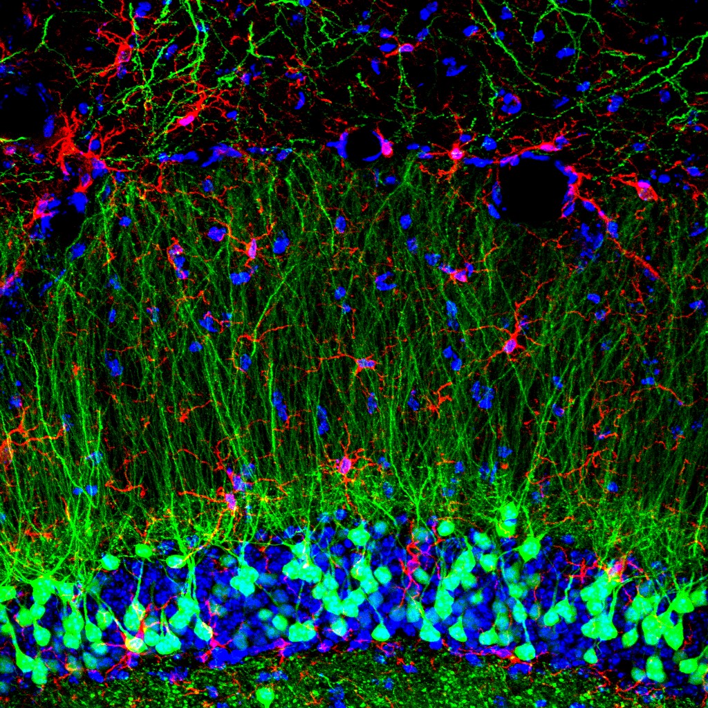 NASA microglia