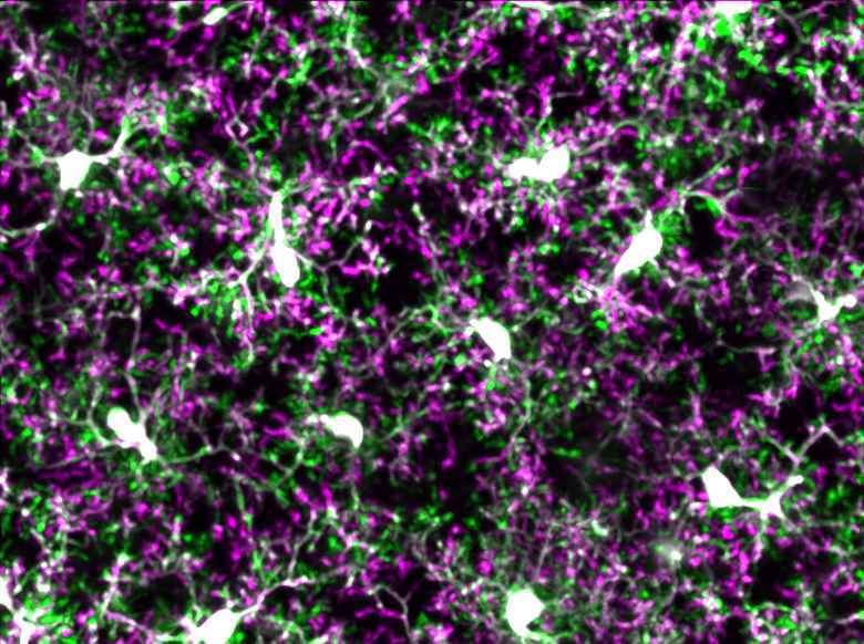 microglia study image
