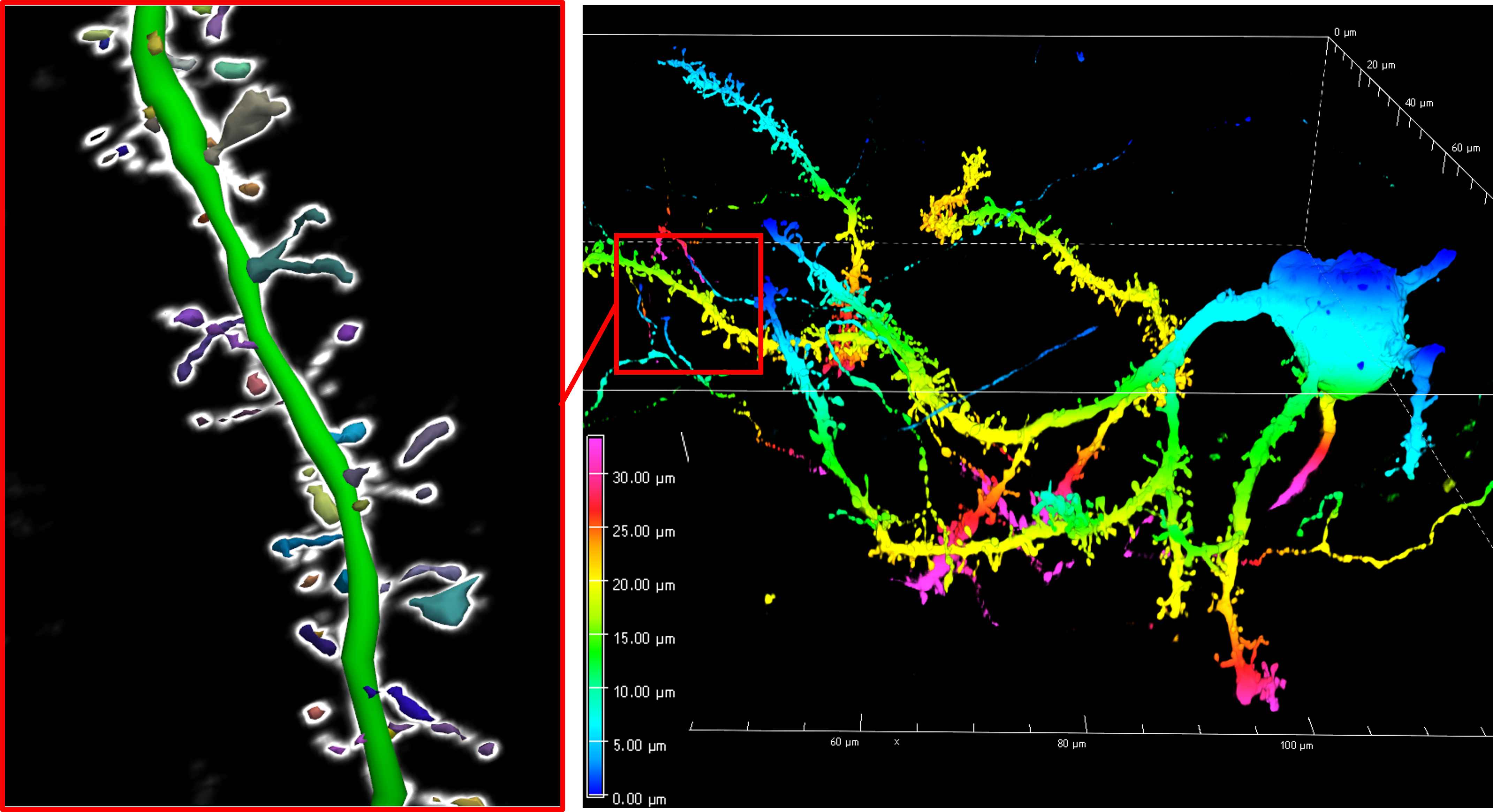 Spines and dendrites