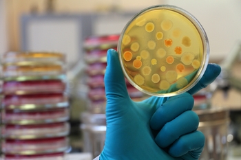 a petri dish with bacteria growing on it.