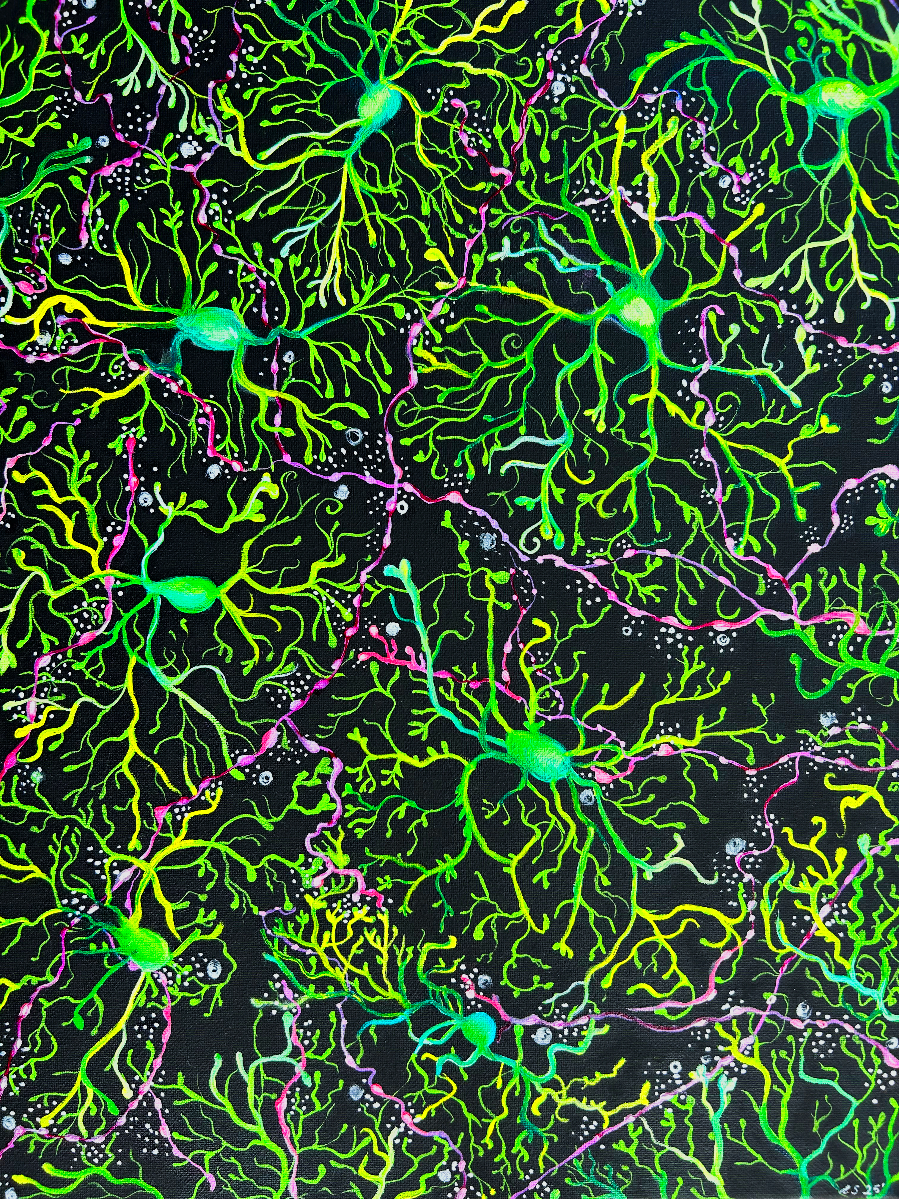 Microglia _ Da axon painting