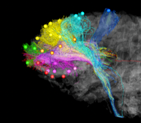 Map of circuits within the brain
