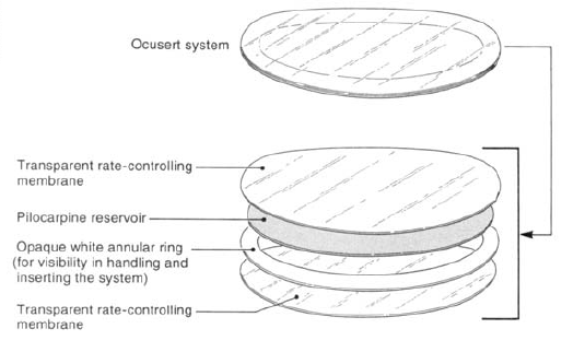 Diagram of the Ocusert system.
