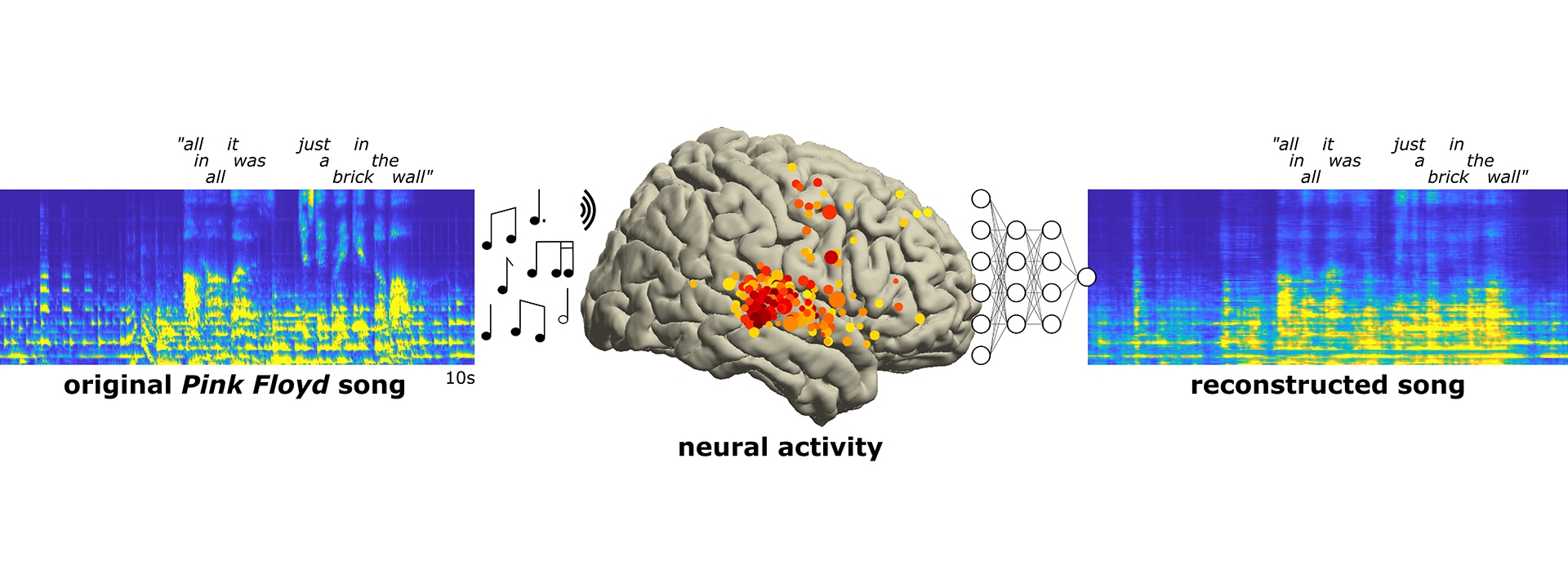 Brain recordings capture musicality of speech — with help from Pink ...