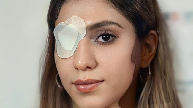 An informal portrait of Kosar Eftekhari with a medical patch over her right eye