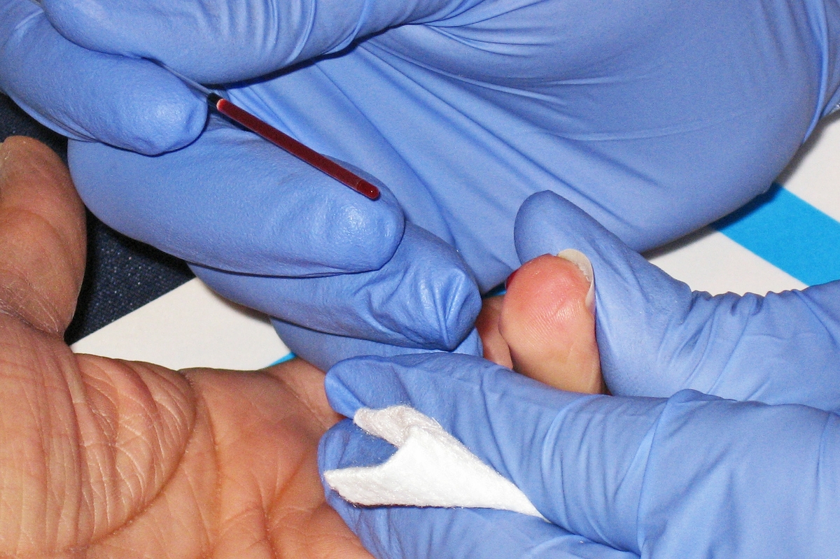 Cholesterol test - finger