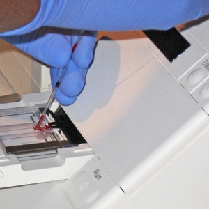 Less than half of patients prescribed new cholesterol drug receive insurance approval