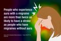 Migraine with aura linked to clot-caused strokes