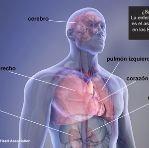 El aumento de la enfermedad renal resalta la importante conexión entre el corazón y los riñones
