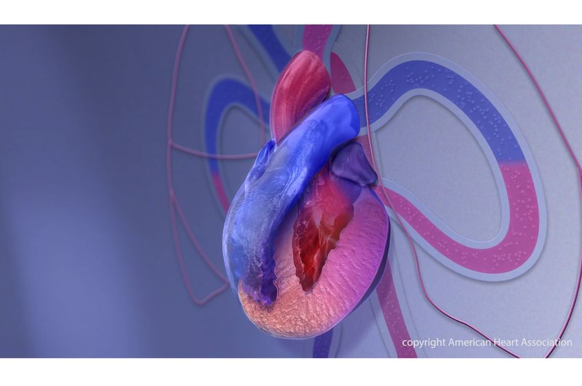 Identifying the cause of heart muscle disease in children is key to