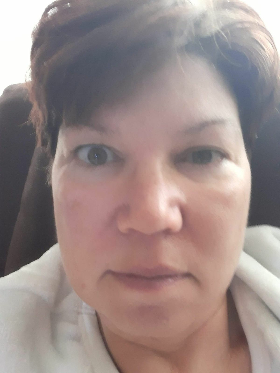 photo-shelly-after-stroke-with-remaining-impacts-american-heart