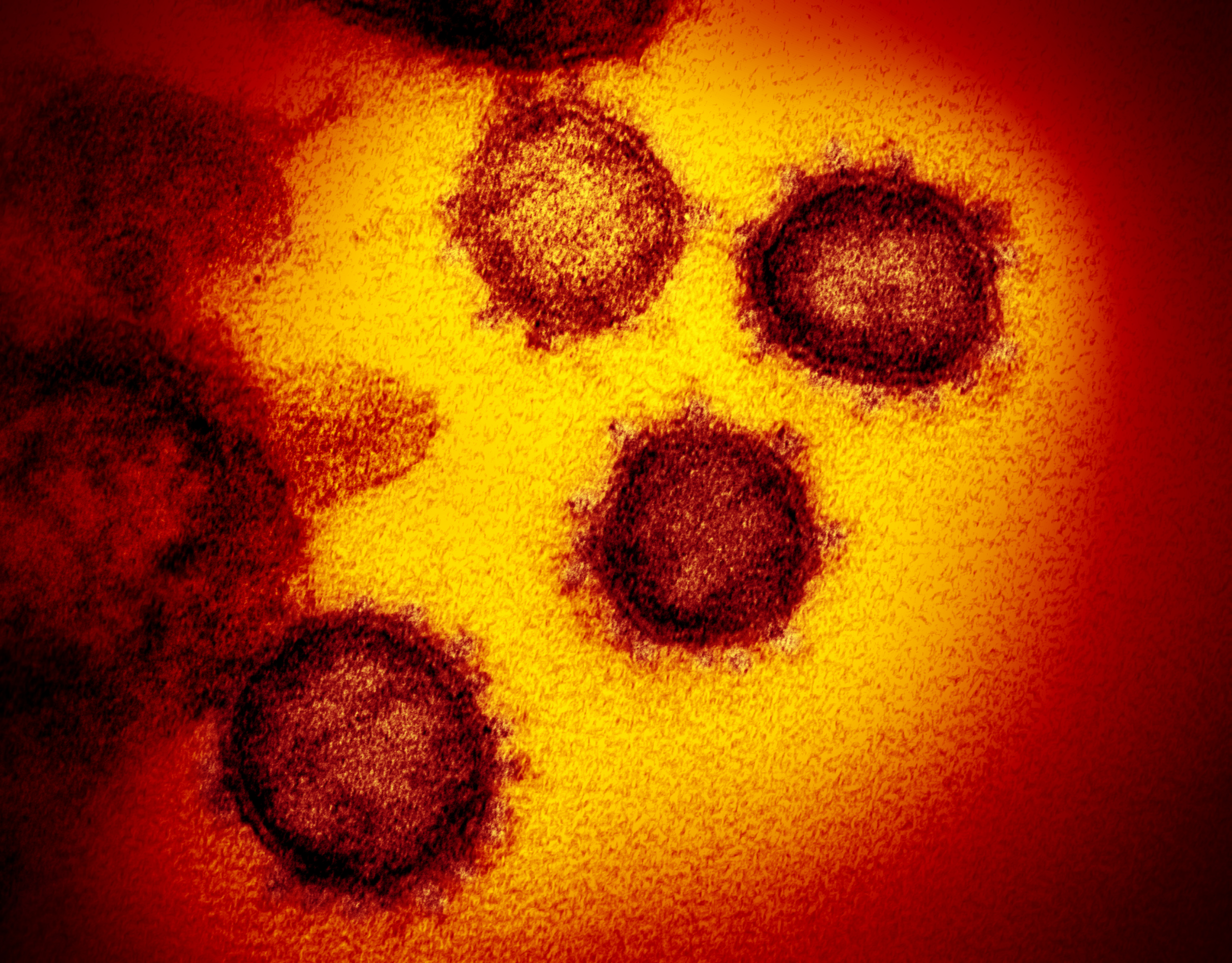 Coronavirus cases top 784,000 globally