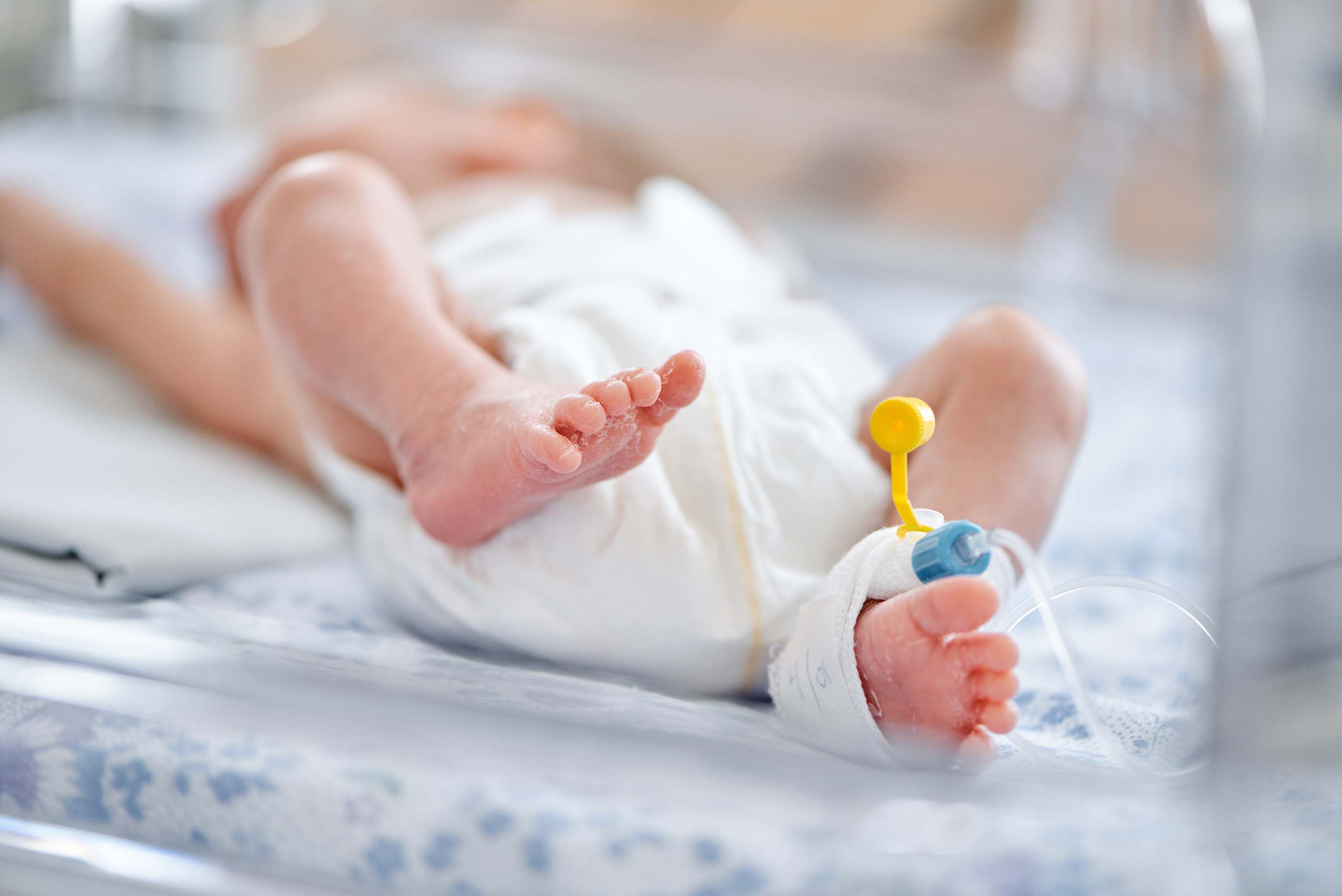 A newborn’s fat mass is associated with obesity as a preschooler, study finds