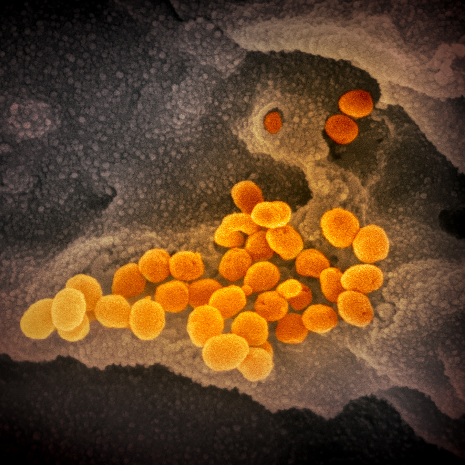 August 7 coronavirus news