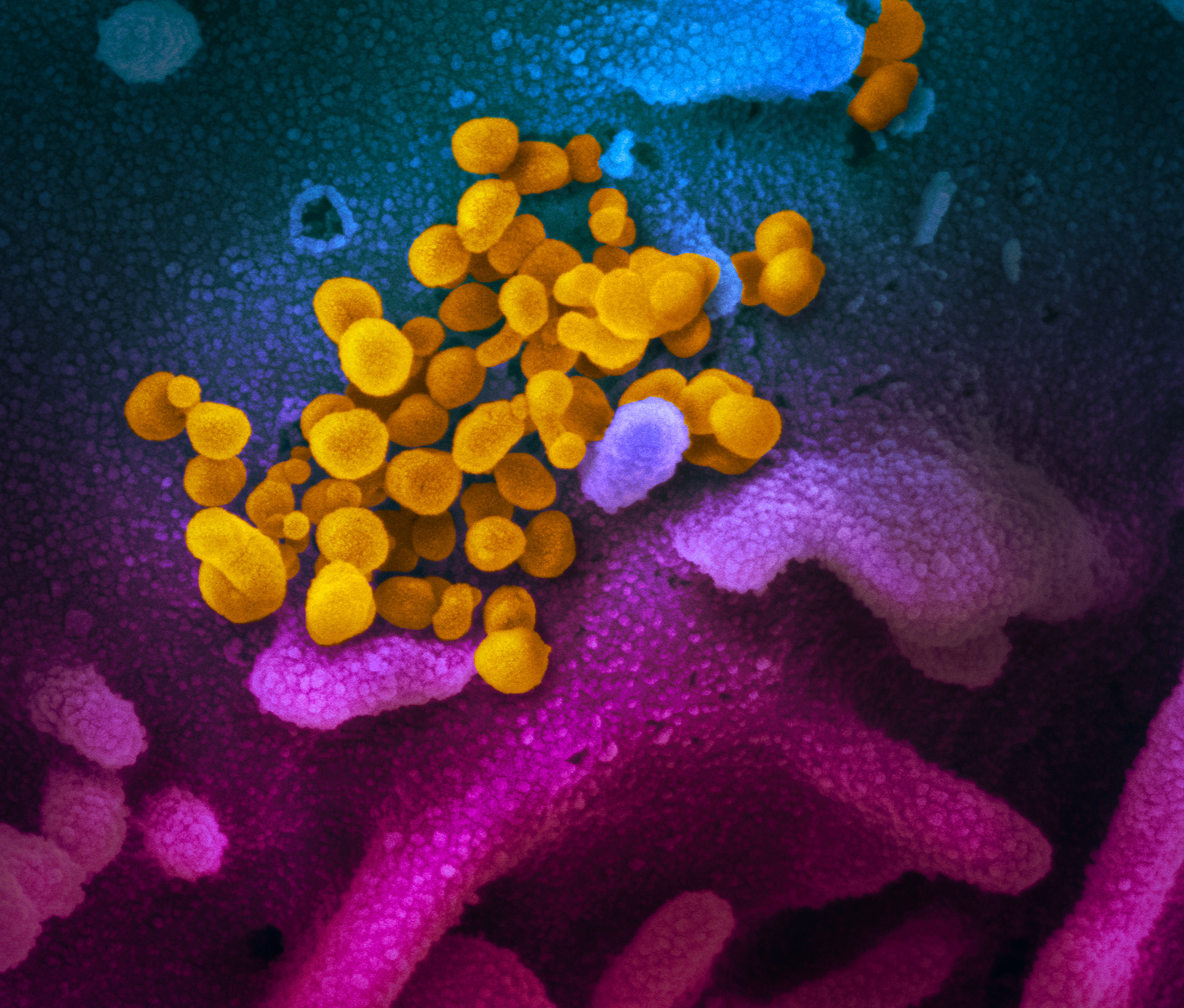 The latest on the coronavirus pandemic