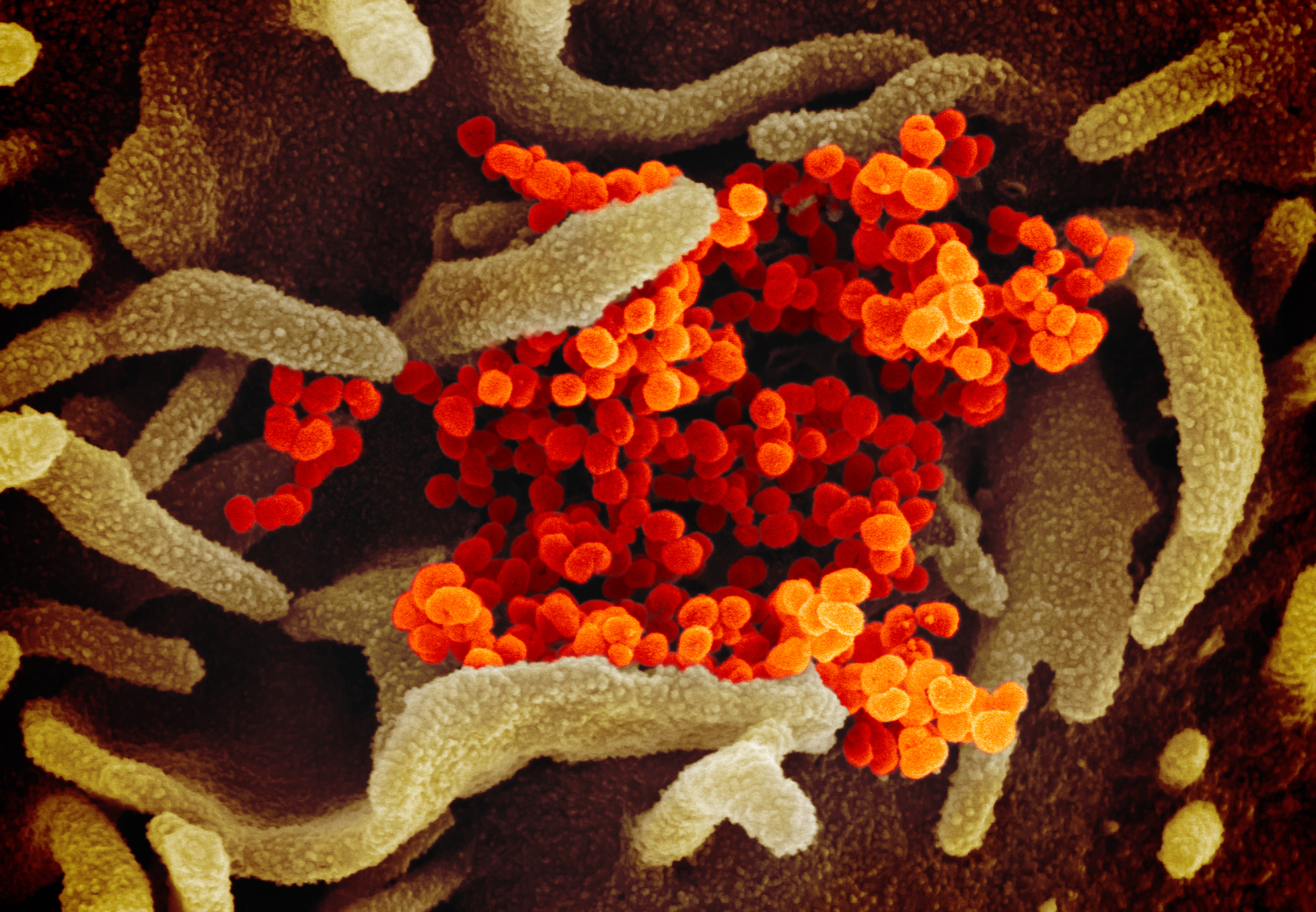 The latest on the coronavirus pandemic and vaccines