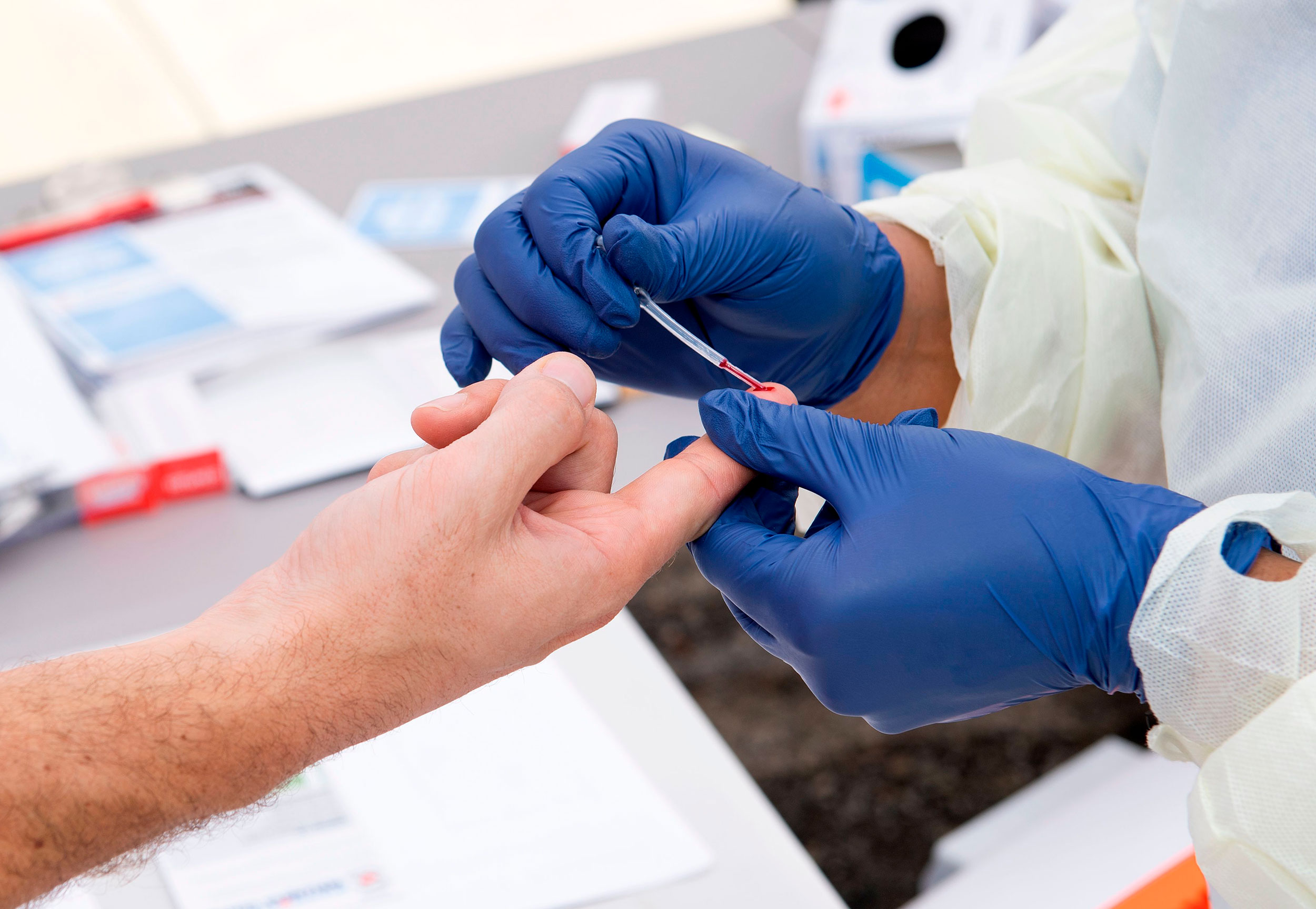 FDA authorizes new Covid-19 antibody test that quantifies specific levels of antibodies