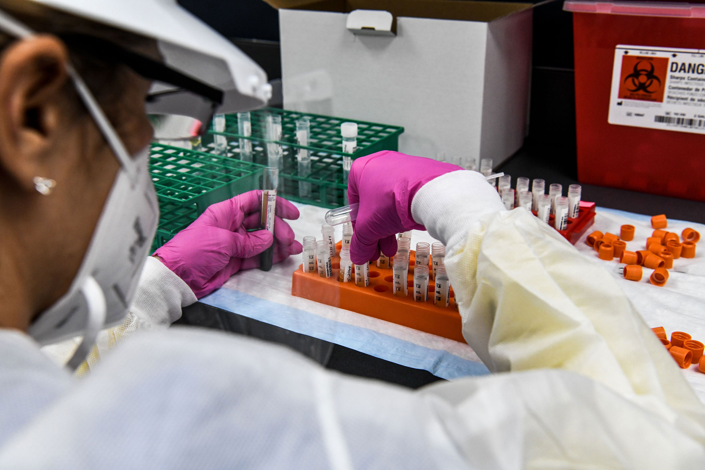 A new study found coronavirus may have been in the US in December. That doesn't mean you'll ever know if you had it then