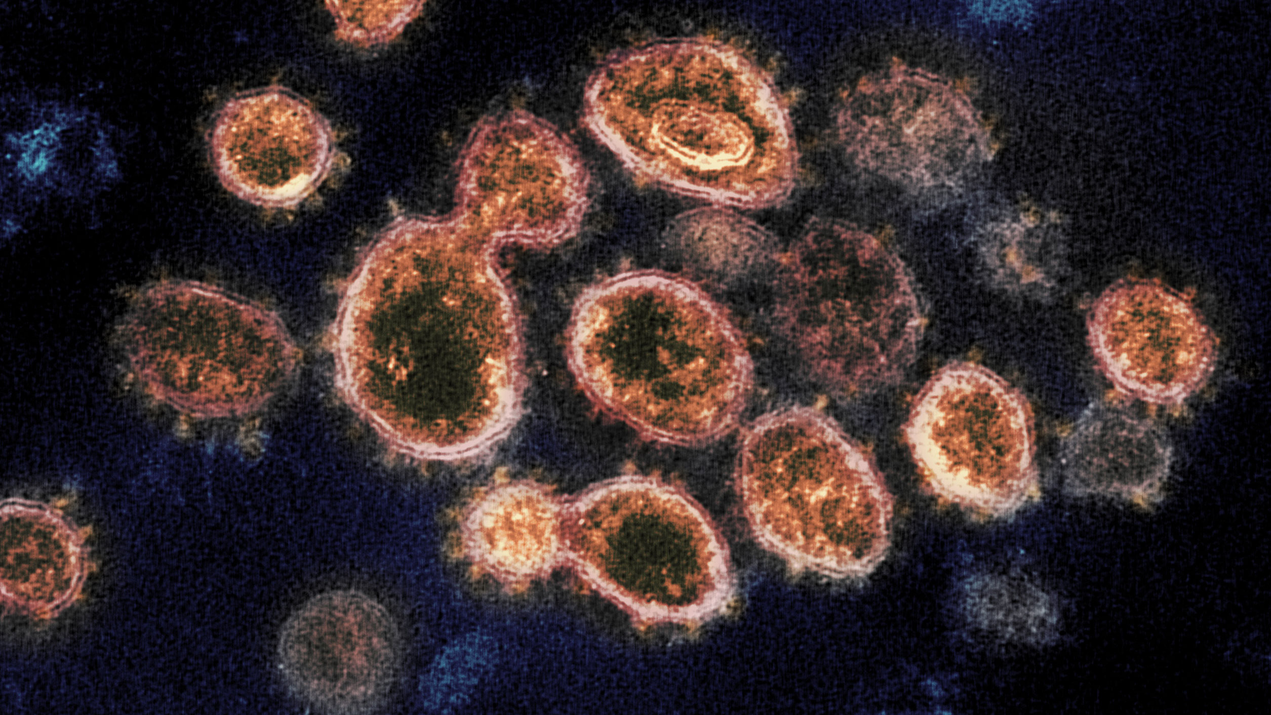 Covid-19 antibodies may protect against reinfection later, study suggests