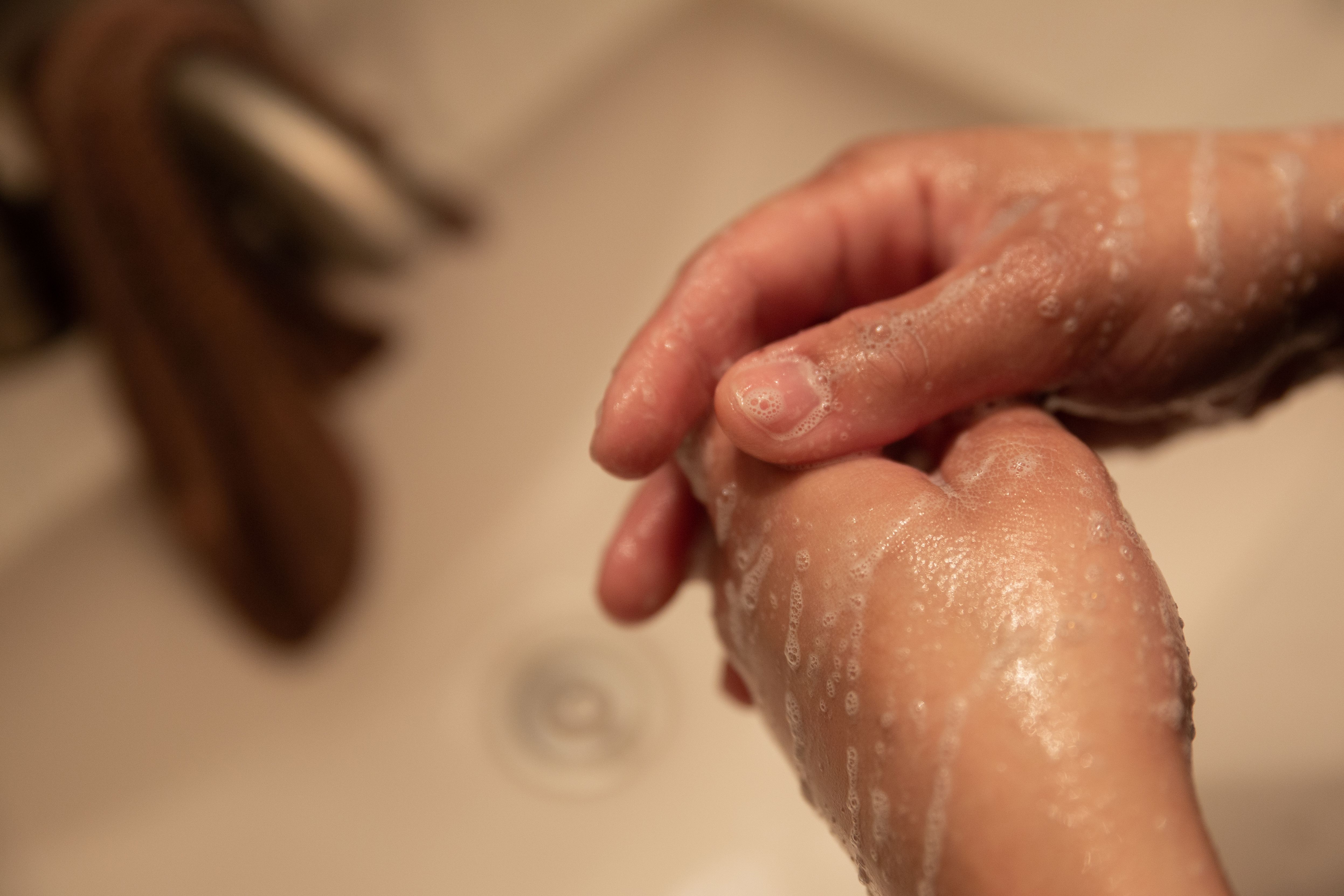 Covid-19 is making some athletes with OCD scrub their hands down to the underlying muscle and tissue