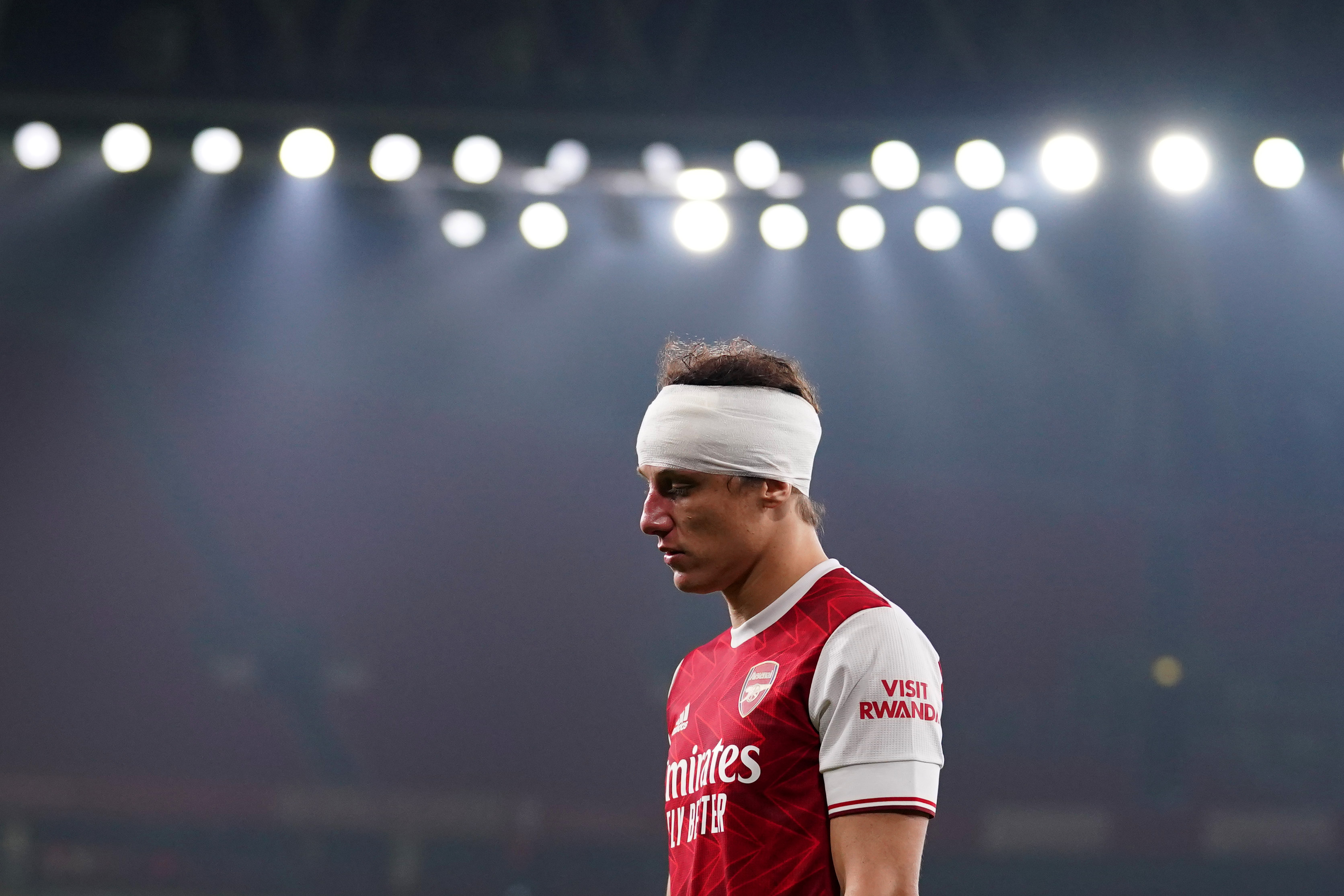 'How many warnings does football need?' Sickening clash of heads puts concussion protocols under scrutiny
