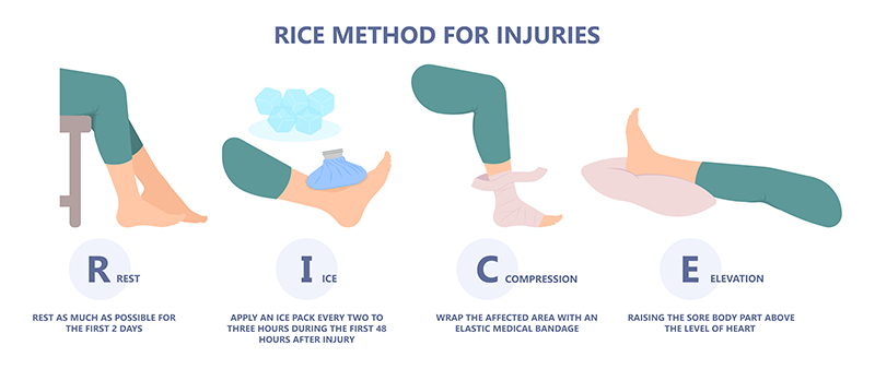 R.I.C.E Method treat injury knee ankle sprain pain heal sore: Enter key opens full-screen view with caption; escape key exits full screen.