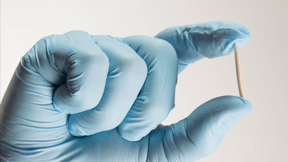 Implanon como funciona o implante anticoncepcional?