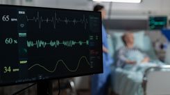 Após casos de parada cardíaca ou infarto, o paciente pode precisar ficar internado. Tela com registros dos batimentos cardíacos.