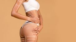 A lipoaspiração é um procedimento que requer precauções específicas e deve ser realizado em um ambiente apropriado, como um hospital ou clínica especializada, que esteja equipado com as condições necessárias para assegurar a segurança. Corpo de uma mulher com marcações dos músculos.