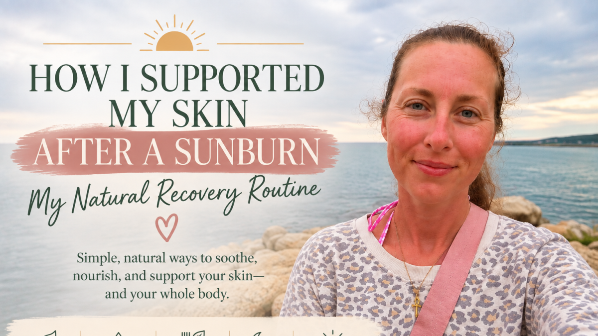 How I Supported My Skin After a Sunburn Naturally