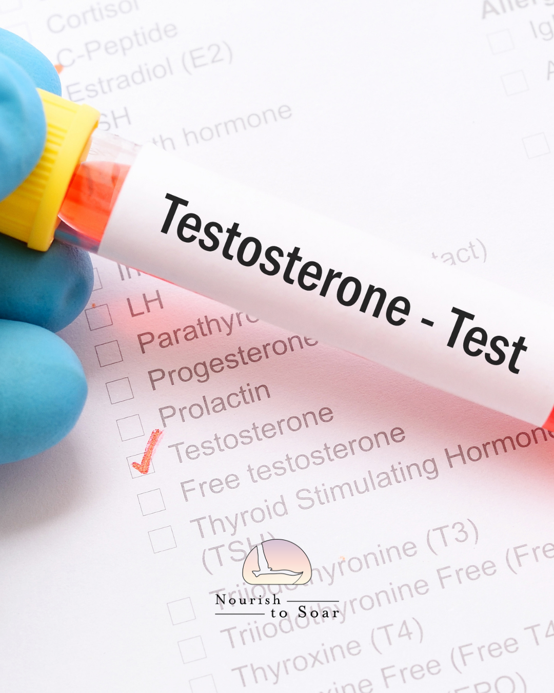 Should Men Be Testing Their Testosterone, or Is It Clever Marketing?
