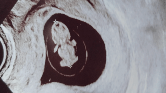 Minä jäin eloon osa 5