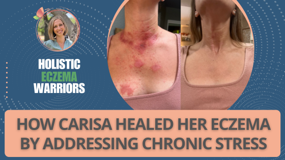 The Hidden Root Cause: How Carisa Healed Her Eczema by Addressing Chronic Stress