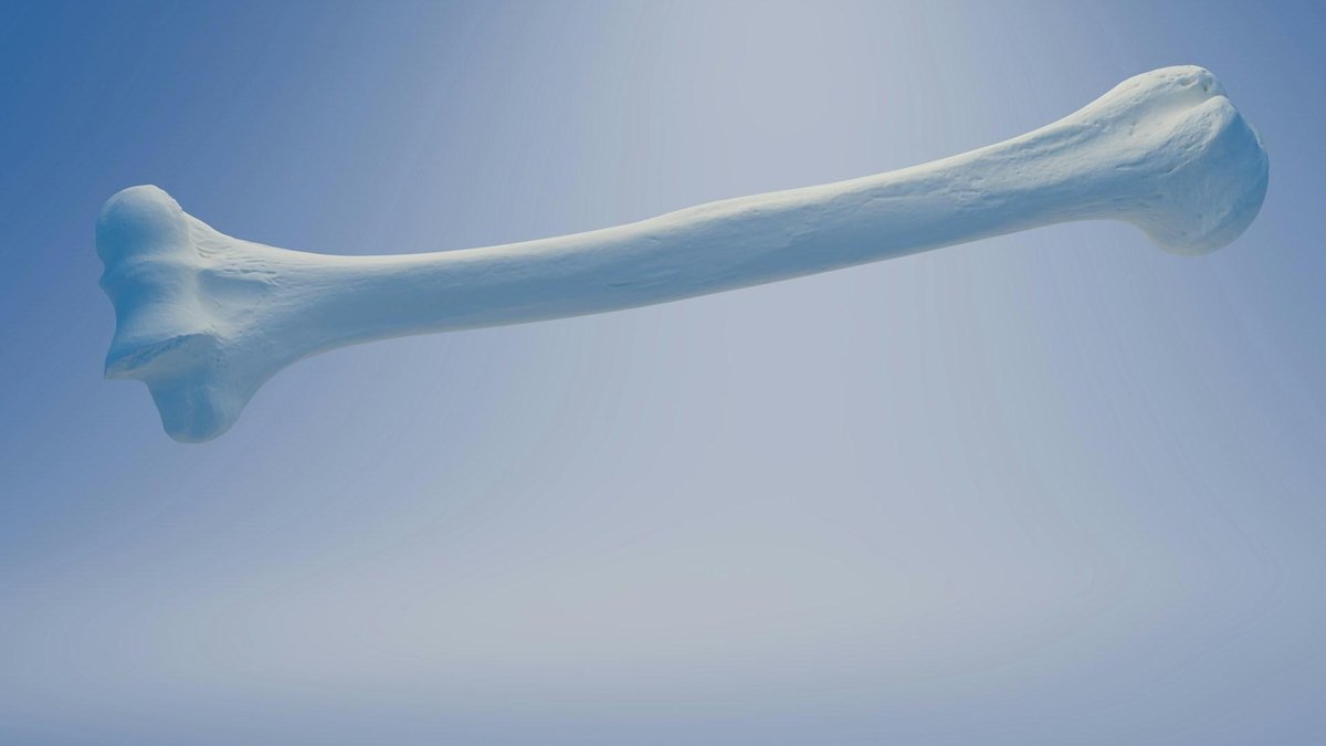 The Bone Density Solution Reviews: Can Shelly Manning’s Program Really Reverse Bone Loss Naturally?