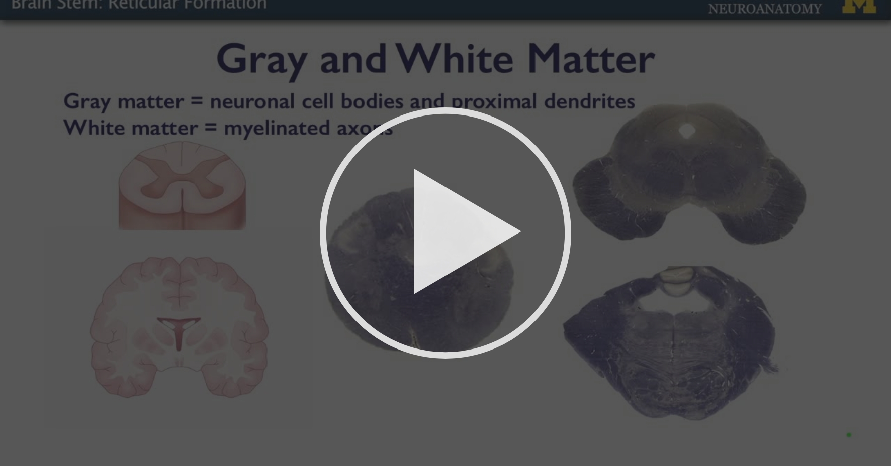 Brain Stem Reticular Formation Brain Stem and Cranial Nerves Coursera