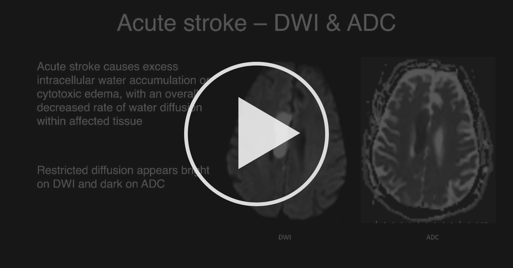 Brain MRI Pathology Skull and Brain Radiology Coursera