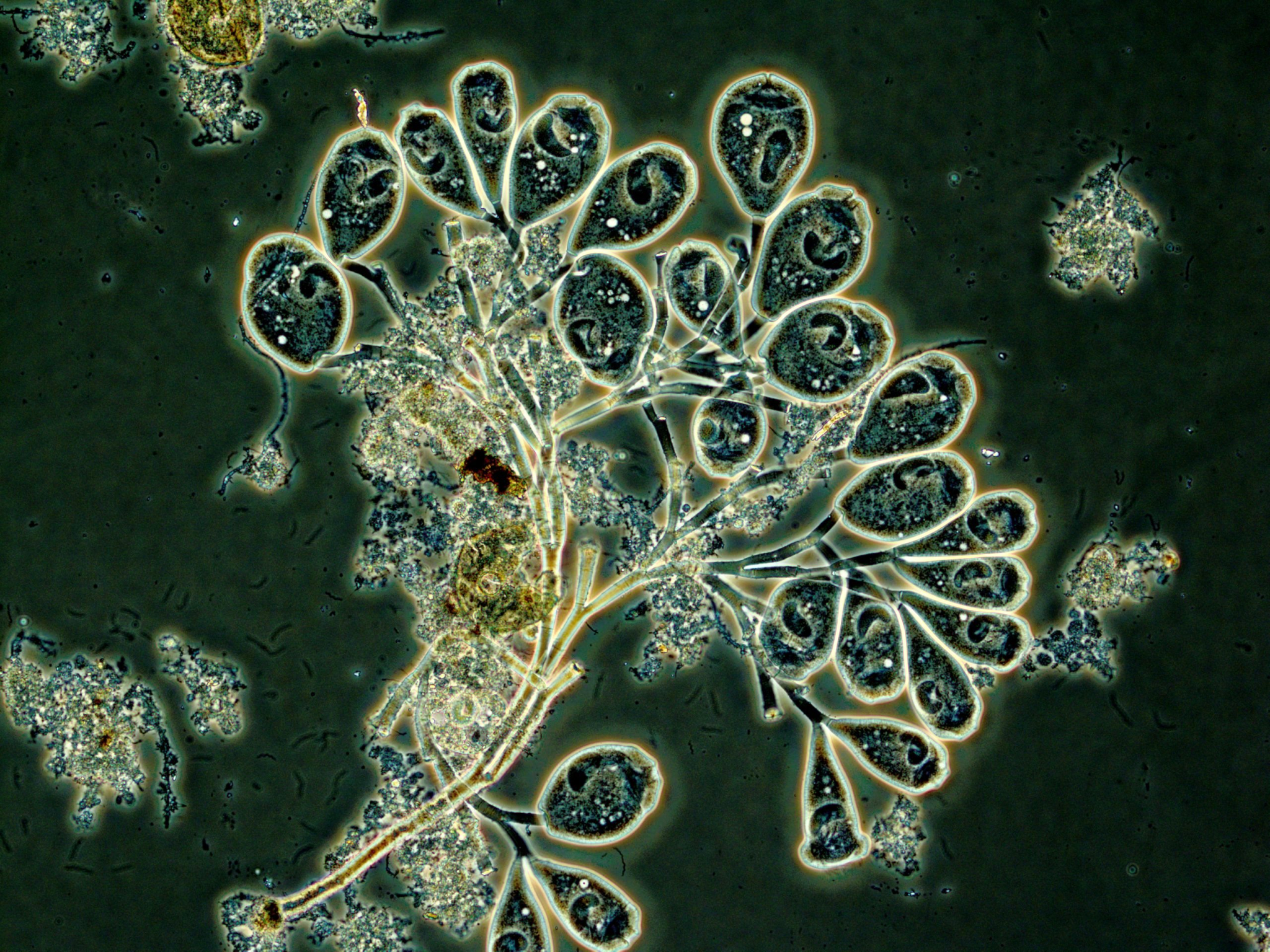 Hands-on Microbiology for Process Control and Troubleshooting | Bristol ...