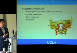 Obex Exploration & Duraplasty to Improve Syrinx Resolution Following Chiari Decompression