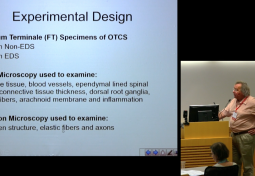 Histopathology of Occult Tethered Cord Syndrome in Ehlers-Danlos Syndrome