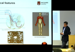 Syringomyelia Pathophysiology: Basic & Clinical Science