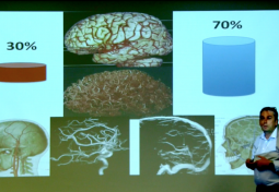 CSF & Cerebral Blood Flow: What is Normal Flow?