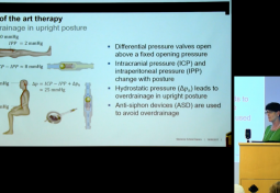 Control of Active CSF Shunts: Is Pulse Pressure Amplitude a Suitable Control?