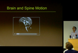 Measuring Brain Displacement with DENSE MRI
