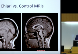 Proposal of a Cerebellar Cognitive Test Battery: An Adult Perspective