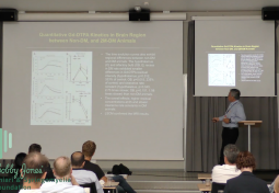 Imaging & Modeling Glymphatic Responses in Diabetes