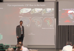 CSF Dynamics in Perivascular Space